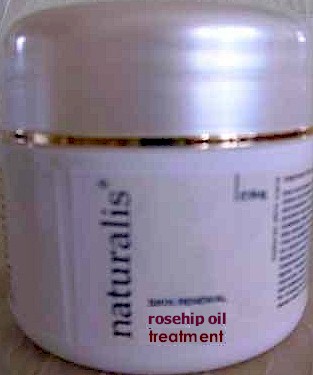 nprosehip.jpg (215391 bytes)